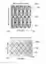 Fig. 02 - Method of securing a prosthesis