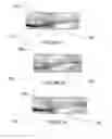 Fig. 07 - Method of securing a prosthesis