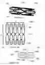 Fig. 13 - Method of securing a prosthesis