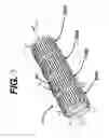 Fig. 04 - Stent segments axially connected by thin film