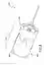 Fig. 14 - Methods and apparatuses for deploying minimally-invasive heart valves