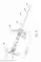 Fig. 15 - Methods and apparatuses for deploying minimally-invasive heart valves