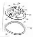 Fig. 01 - Methods of assembling and delivering a cardiac implant