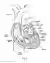 Fig. 02 - Methods of assembling and delivering a cardiac implant