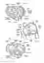 Fig. 03 - Methods of assembling and delivering a cardiac implant