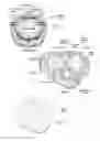 Fig. 04 - Methods of assembling and delivering a cardiac implant