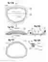 Fig. 06 - Methods of assembling and delivering a cardiac implant