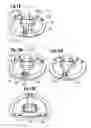 Fig. 10 - Methods of assembling and delivering a cardiac implant