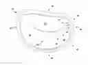 Fig. 01 - Apparatus and method for treating a regurgitant heart valve