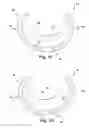 Fig. 05 - Apparatus and method for treating a regurgitant heart valve