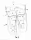 Fig. 09 - Apparatus and method for treating a regurgitant heart valve