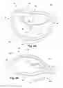 Fig. 12 - Apparatus and method for treating a regurgitant heart valve