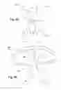 Fig. 13 - Apparatus and method for treating a regurgitant heart valve