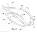 Fig. 16 - Apparatus and method for treating a regurgitant heart valve