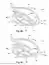 Fig. 17 - Apparatus and method for treating a regurgitant heart valve