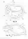 Fig. 18 - Apparatus and method for treating a regurgitant heart valve