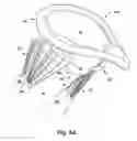 Fig. 23 - Apparatus and method for treating a regurgitant heart valve
