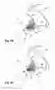 Fig. 24 - Apparatus and method for treating a regurgitant heart valve
