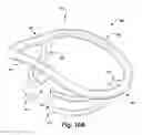 Fig. 25 - Apparatus and method for treating a regurgitant heart valve