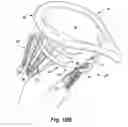 Fig. 26 - Apparatus and method for treating a regurgitant heart valve