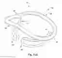Fig. 27 - Apparatus and method for treating a regurgitant heart valve