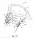Fig. 28 - Apparatus and method for treating a regurgitant heart valve