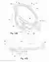 Fig. 29 - Apparatus and method for treating a regurgitant heart valve