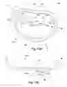 Fig. 31 - Apparatus and method for treating a regurgitant heart valve
