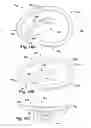 Fig. 32 - Apparatus and method for treating a regurgitant heart valve