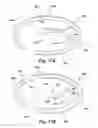 Fig. 37 - Apparatus and method for treating a regurgitant heart valve