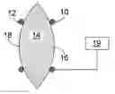 Fig. 01 - VISION PROSTHESIS WITH ARTIFICIAL MUSCLE ACTUATOR