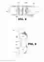 Fig. 06 - SYSTEM AND METHOD FOR BREAST AUGMENTATION