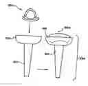Fig. 01 - Facet Arthroplasty Devices and Methods