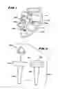 Fig. 02 - Facet Arthroplasty Devices and Methods