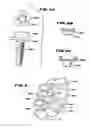 Fig. 03 - Facet Arthroplasty Devices and Methods