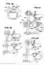 Fig. 08 - Facet Arthroplasty Devices and Methods