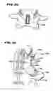 Fig. 09 - Facet Arthroplasty Devices and Methods
