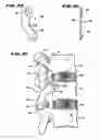 Fig. 14 - Facet Arthroplasty Devices and Methods