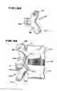 Fig. 16 - Facet Arthroplasty Devices and Methods