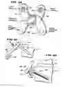 Fig. 18 - Facet Arthroplasty Devices and Methods