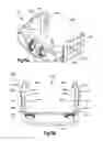 Fig. 17 - Intervertebral implants, systems, and methods of use