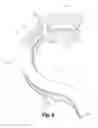 Fig. 10 - Spinal implant system and method