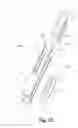 Fig. 15 - Spinal implant system and method