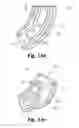 Fig. 18 - Spinal implant system and method