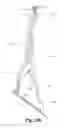 Fig. 20 - Spinal implant system and method