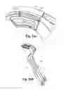 Fig. 24 - Spinal implant system and method