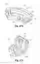 Fig. 26 - Spinal implant system and method