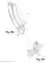 Fig. 28 - Spinal implant system and method