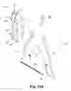 Fig. 37 - Spinal implant system and method