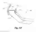 Fig. 41 - Spinal implant system and method